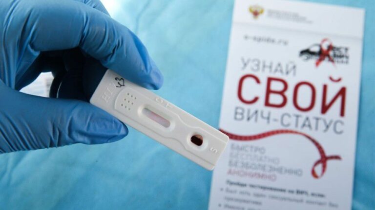 СПИД – это сочетание болезней, вызванных недостаточной работой иммунной системы вследствие поражения ее ВИЧ.